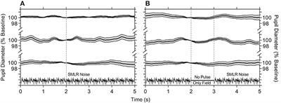 Melanopsin and Cone Photoreceptor Inputs to the Afferent Pupil Light Response